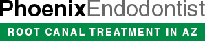 Phoenix Endodontist - Root Canal Treatment in AZ